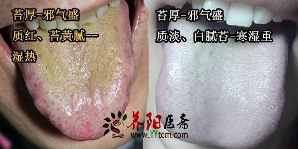 中医二羊:咳嗽反反复复发作,看遍中西医效果不好,只因没忌口