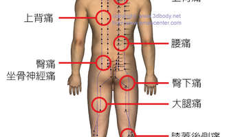 身体常见的疼痛及相关经络穴位分部图
